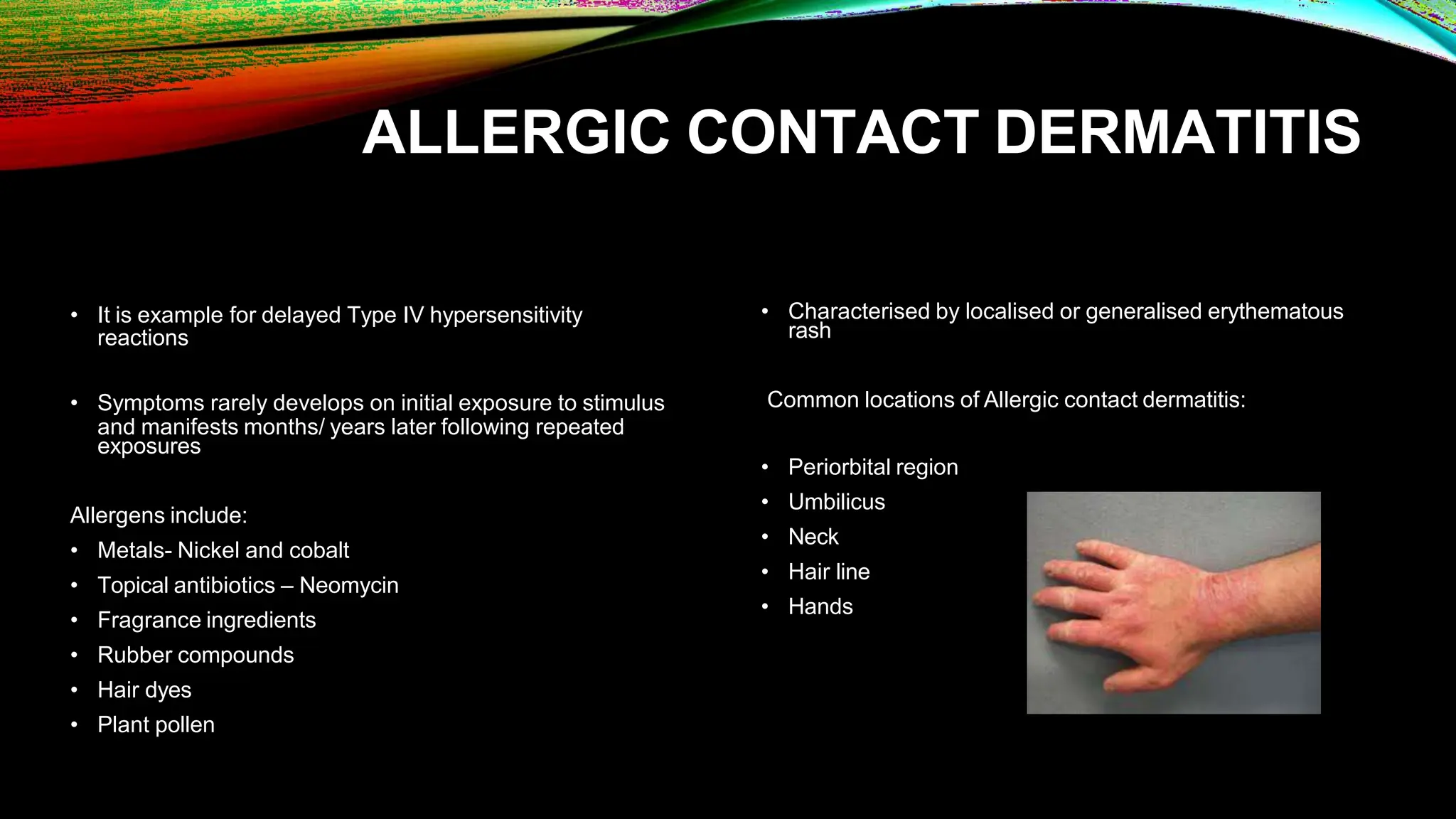 eczema complete information including treatment | PPTX