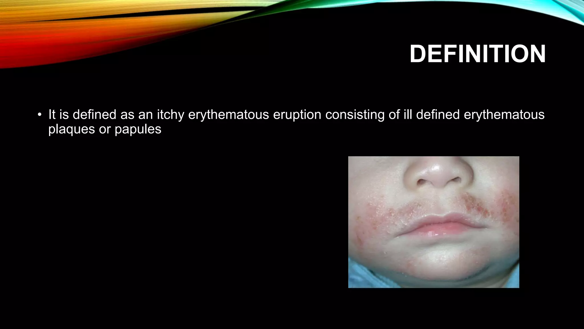 Eczema or Dermatitis | PPTX