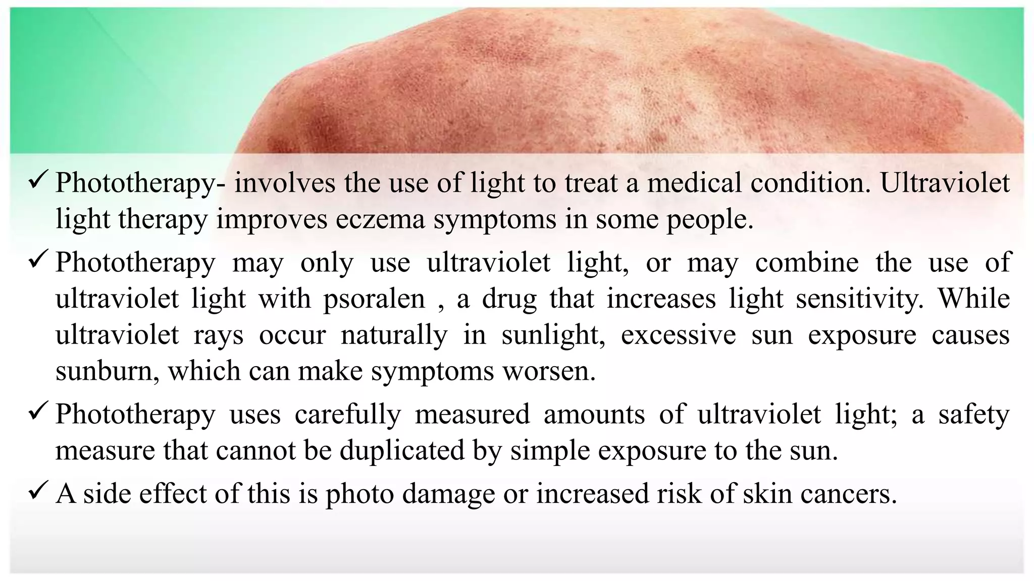 Photo inspiration: Gallery Detail: Eczema Pptx