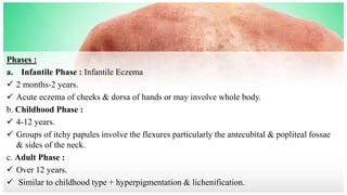 Phases :
a. Infantile Phase : Infantile Eczema
 2 months-2 years.
 Acute eczema of cheeks & dorsa of hands or may involve whole body.
b. Childhood Phase :
 4-12 years.
 Groups of itchy papules involve the flexures particularly the antecubital & popliteal fossae
& sides of the neck.
c. Adult Phase :
 Over 12 years.
 Similar to childhood type + hyperpigmentation & lichenification.
 