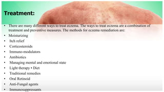 Treatment:
• There are many different ways to treat eczema. The ways to treat eczema are a combination of
treatment and preventive measures. The methods for eczema remediation are:
• Moisturizing
• Itch relief
• Corticosteroids
• Immuno-modulators
• Antibiotics
• Managing mental and emotional state
• Light therapy • Diet
• Traditional remedies
• Oral Retinoid
• Anti-Fungal agents
• Immunosuppressants
 