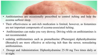 • Antihistamines are occasionally prescribed to control itching and help the
eczema sufferer sleep.
• Their effectiveness as anti-itch medication is limited, however, as histamines
are not important components of eczema-associated itching.
• Antihistamines can make you very drowsy. Driving while on antihistamines is
not recommended.
• sedating antihistamines such as promethazine (Phenergan) diphenhydramine
(Benadryl) are more effective at relieving itch than the newer, nonsedating
antihistamines.
• Dosage and Administration: Diphenhydramine 25-50 mg Two times daily or
at night.
 