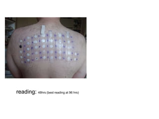 reading: 48hrs (best reading at 96 hrs)
 