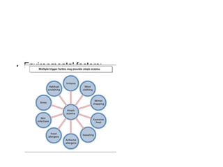 • Environmental factors:
 