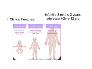 • Clinical Features:
Infantile-3 mnths-2 years
adolescent-2yrs-12 yrs
 