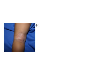 • Childhood Phase:
 