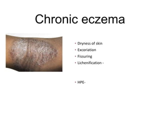 Chronic eczema
▪ Dryness of skin
▪ Excoriation
▪ Fissuring
▪ Lichenification -
▪ HPE-
 