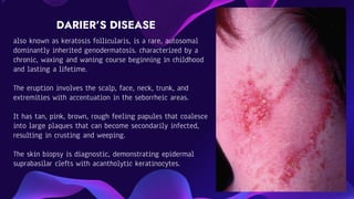 Eczema pptx eczema-pptx