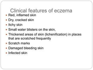 Clinical features of eczema
 Red, inflamed skin
 Dry, cracked skin
 Itchy skin
 Small water blisters on the skin,
 Thickened areas of skin (lichenification) in places
that are scratched frequently
 Scratch marks
 Damaged bleeding skin
 Infected skin
 