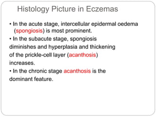 Histology Picture in Eczemas
• In the acute stage, intercellular epidermal oedema
(spongiosis) is most prominent.
• In the subacute stage, spongiosis
diminishes and hyperplasia and thickening
of the prickle-cell layer (acanthosis)
increases.
• In the chronic stage acanthosis is the
dominant feature.
 
