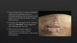 Exaggerated Skin skin disease Eczema pharmacotherapeutics | PPTX