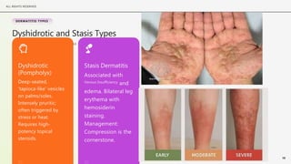 Tapioca Like Rash Comprehensive Management of Dermatitis and Eczema: Diagnosis, Treatment ...