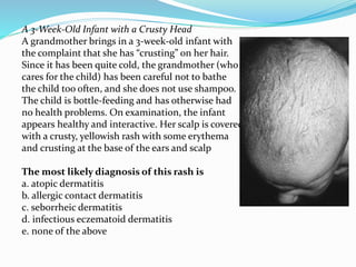 Eczema basic principles | PPTX