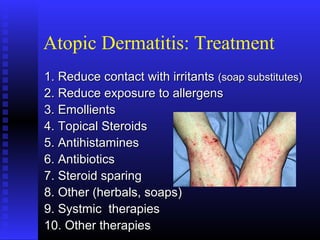Atopic Dermatitis: Treatment
1. Reduce contact with irritants1. Reduce contact with irritants (soap substitutes)(soap substitutes)
2. Reduce exposure to allergens2. Reduce exposure to allergens
3. Emollients3. Emollients
4. Topical Steroids4. Topical Steroids
5. Antihistamines5. Antihistamines
6. Antibiotics6. Antibiotics
7. Steroid sparing7. Steroid sparing
8. Other (herbals, soaps)8. Other (herbals, soaps)
9. Systmic therapies9. Systmic therapies
10. Other therapies10. Other therapies
 
