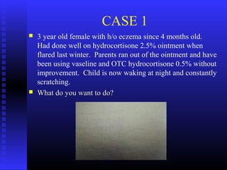 CASE 1
 3 year old female with h/o eczema since 4 months old.
Had done well on hydrocortisone 2.5% ointment when
flared last winter. Parents ran out of the ointment and have
been using vaseline and OTC hydrocortisone 0.5% without
improvement. Child is now waking at night and constantly
scratching.
 What do you want to do?What do you want to do?
 