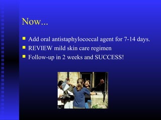 Now...
 Add oral antistaphylococcal agent for 7-14 days.
 REVIEW mild skin care regimen
 Follow-up in 2 weeks and SUCCESS!
 