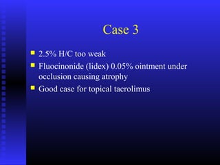 Case 3
 2.5% H/C too weak
 Fluocinonide (lidex) 0.05% ointment under
occlusion causing atrophy
 Good case for topical tacrolimus
 