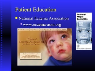 Patient Education
 National Eczema AssociationNational Eczema Association
 www.eczema-assn.orgwww.eczema-assn.org
 