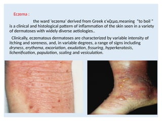 Comprehensive Overview of Eczema and Atopic Dermatitis: Pathogenesis ...