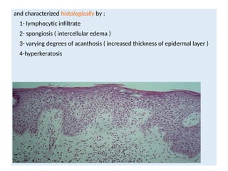 Comprehensive Overview of Eczema and Atopic Dermatitis: Pathogenesis ...