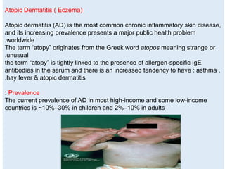 Comprehensive Overview of Eczema and Atopic Dermatitis: Pathogenesis ...