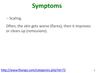 Symptoms
   -- Scaling.
   Often, the skin gets worse (flares), then it improves
   or clears up (remissions).




http://www.fitango.com/categories.php?id=72                5
 