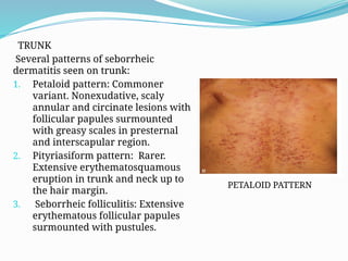 Comprehensive Overview of Eczema and Dermatitis: Types, Diagnosis, and ...