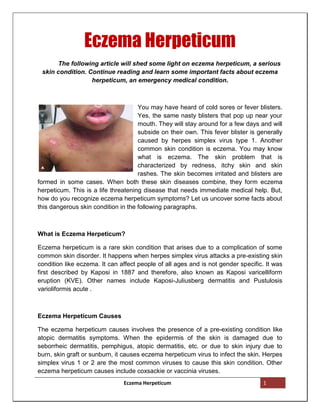 Eczema Herpeticum
      The following article will shed some light on eczema herpeticum, a serious
 skin condition. Continue reading and learn some important facts about eczema
                  herpeticum, an emergency medical condition.



                                     You may have heard of cold sores or fever blisters.
                                     Yes, the same nasty blisters that pop up near your
                                     mouth. They will stay around for a few days and will
                                     subside on their own. This fever blister is generally
                                     caused by herpes simplex virus type 1. Another
                                     common skin condition is eczema. You may know
                                     what is eczema. The skin problem that is
                                     characterized by redness, itchy skin and skin
                                     rashes. The skin becomes irritated and blisters are
formed in some cases. When both these skin diseases combine, they form eczema
herpeticum. This is a life threatening disease that needs immediate medical help. But,
how do you recognize eczema herpeticum symptoms? Let us uncover some facts about
this dangerous skin condition in the following paragraphs.



What is Eczema Herpeticum?

Eczema herpeticum is a rare skin condition that arises due to a complication of some
common skin disorder. It happens when herpes simplex virus attacks a pre-existing skin
condition like eczema. It can affect people of all ages and is not gender specific. It was
first described by Kaposi in 1887 and therefore, also known as Kaposi varicelliform
eruption (KVE). Other names include Kaposi-Juliusberg dermatitis and Pustulosis
varioliformis acute .



Eczema Herpeticum Causes

The eczema herpeticum causes involves the presence of a pre-existing condition like
atopic dermatitis symptoms. When the epidermis of the skin is damaged due to
seborrheic dermatitis, pemphigus, atopic dermatitis, etc. or due to skin injury due to
burn, skin graft or sunburn, it causes eczema herpeticum virus to infect the skin. Herpes
simplex virus 1 or 2 are the most common viruses to cause this skin condition. Other
eczema herpeticum causes include coxsackie or vaccinia viruses.
                               Eczema Herpeticum                                  1
 