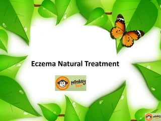 Eczema Natural Treatment
 