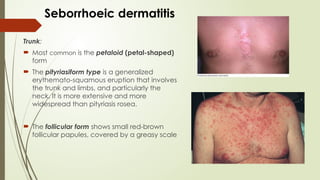 ECZEMA( dermatitis) PART 2.pptx in dermatology | PPTX