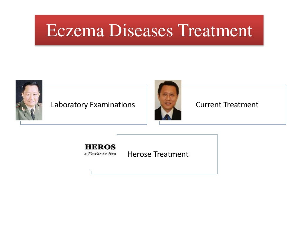 Eczema treatment in singapore