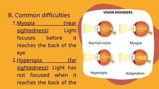 B. Common difficulties
1.Myopia (near
sightedness): Light
focuses before it
reaches the back of the
eye
2.Hyperopia (far
sightedness): Light has
not focused when it
reaches the back of the
 