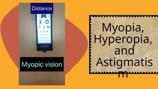 Myopia,
Hyperopia,
and
Astigmatis
m
 
