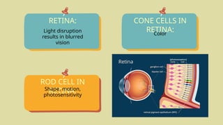 RETINA:
Light disruption
results in blurred
vision
ROD CELL IN
RETINA:
CONE CELLS IN
RETINA:
Shape, motion,
photosensitivity
Color
 