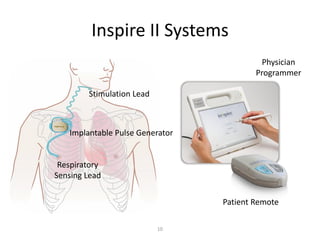 Inspire Patient Guide.pdf UoM 2016 BMEn5920 - Inspire Better Sleep - release | PDF