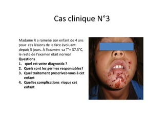 Cas clinique N°3

Madame R a ramené son enfant de 4 ans
pour ces lésions de la face évoluant
depuis 5 jours. À l’examen sa T°= 37.3°C,
le reste de l’examen était normal
Questions
1. quel est votre diagnostic ?
2. Quels sont les germes responsables?
3. Quel traitement prescrivez-vous à cet
    enfant
4. Quelles complications risque cet
    enfant
 