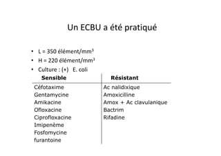 Un ECBU a été pratiqué

• L = 350 élément/mm3
• H = 220 élément/mm3
• Culture : (+) E. coli
   Sensible                 Résistant
 Céfotaxime               Ac nalidixique
 Gentamycine              Amoxicilline
 Amikacine                Amox + Ac clavulanique
 Ofloxacine               Bactrim
 Ciprofloxacine           Rifadine
 Imipenème
 Fosfomycine
 furantoine
 