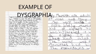 EXAMPLE OF
DYSGRAPHIA
 