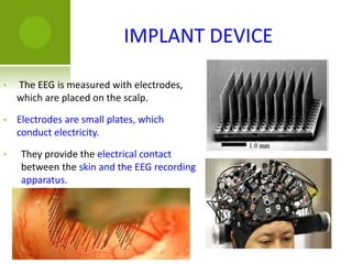 IMPLANT DEVICE
• The EEG is measured with electrodes,
which are placed on the scalp.
• Electrodes are small plates, which
conduct electricity.
• They provide the electrical contact
between the skin and the EEG recording
apparatus.
 
