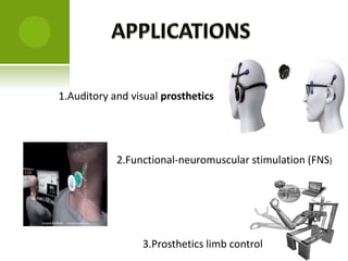 1.Auditory and visual prosthetics
2.Functional-neuromuscular stimulation (FNS)
3.Prosthetics limb control
 
