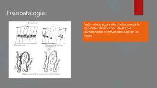 Fisiopatologia
Volumen de agua y electrolitos excede la
capacidad de absorcion en el Colon,
eliminandose en mayor cantidad por las
heces
 