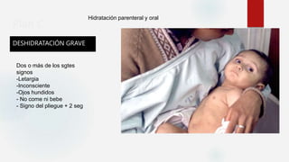 Plan C
DESHIDRATACIÓN GRAVE
Hidratación parenteral y oral
Dos o más de los sgtes
signos
-Letargia
-Inconsciente
-Ojos hundidos
- No come ni bebe
- Signo del pliegue + 2 seg
 