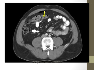 Do you see the free air?
 