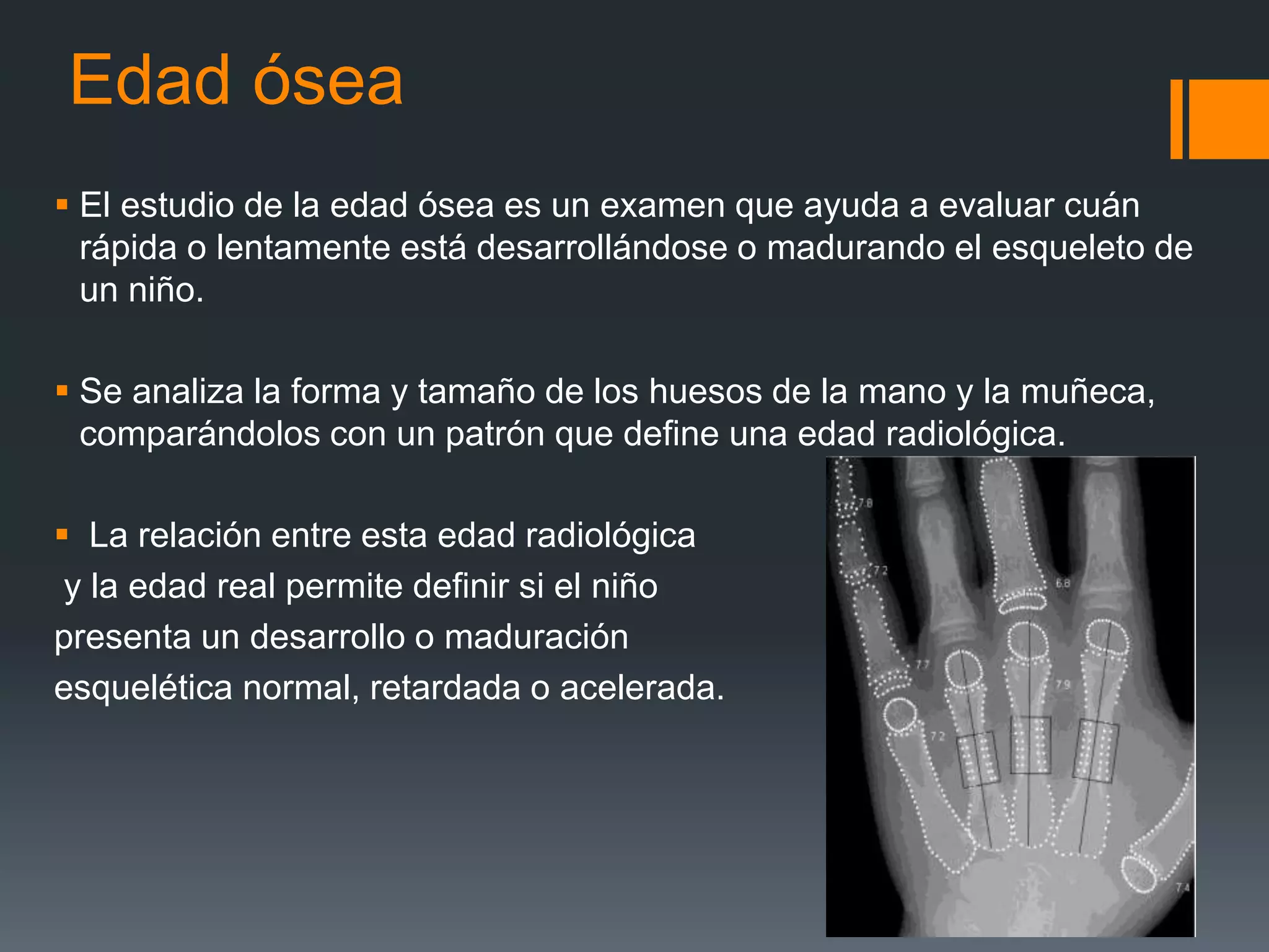 Edad ósea | PPTX