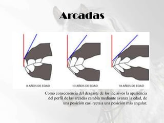 ArcadasComo consecuencia del desgaste de los incisivos la apariencia del perfil de las arcadas cambia mediante avanza la edad, de una posición casi recta a una posición más angular. 