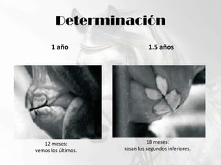 Determinación1 año1.5 años18 meses:rasan los segundos inferiores.12 meses:vemos los últimos.