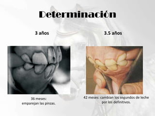 Determinación3 años3.5 años42 meses: cambian los segundos de leche por los definitivos.36 meses:emparejan las pinzas.