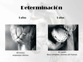 Determinación5 años5 años60 meses:Boca completa, coronas aún huecas.60 meses:emparejan últimos.