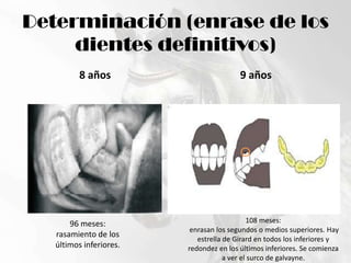 Determinación (enrase de los dientes definitivos)8 años9 años108 meses: enrasan los segundos o medios superiores. Hay estrella de Girard en todos los inferiores yredondez en los últimos inferiores. Se comienza a ver el surco de galvayne.96 meses:rasamiento de losúltimos inferiores.