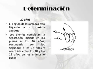 Determinación20 añosEl ángulo de las arcadas está llegando a su máxima agudeza Los dientes completan la separación iniciada en las pinzas a los 16 años, continuada con los segundos a los 17 años y concluida entre los 18 y los 19 años en los últimos o cuñas